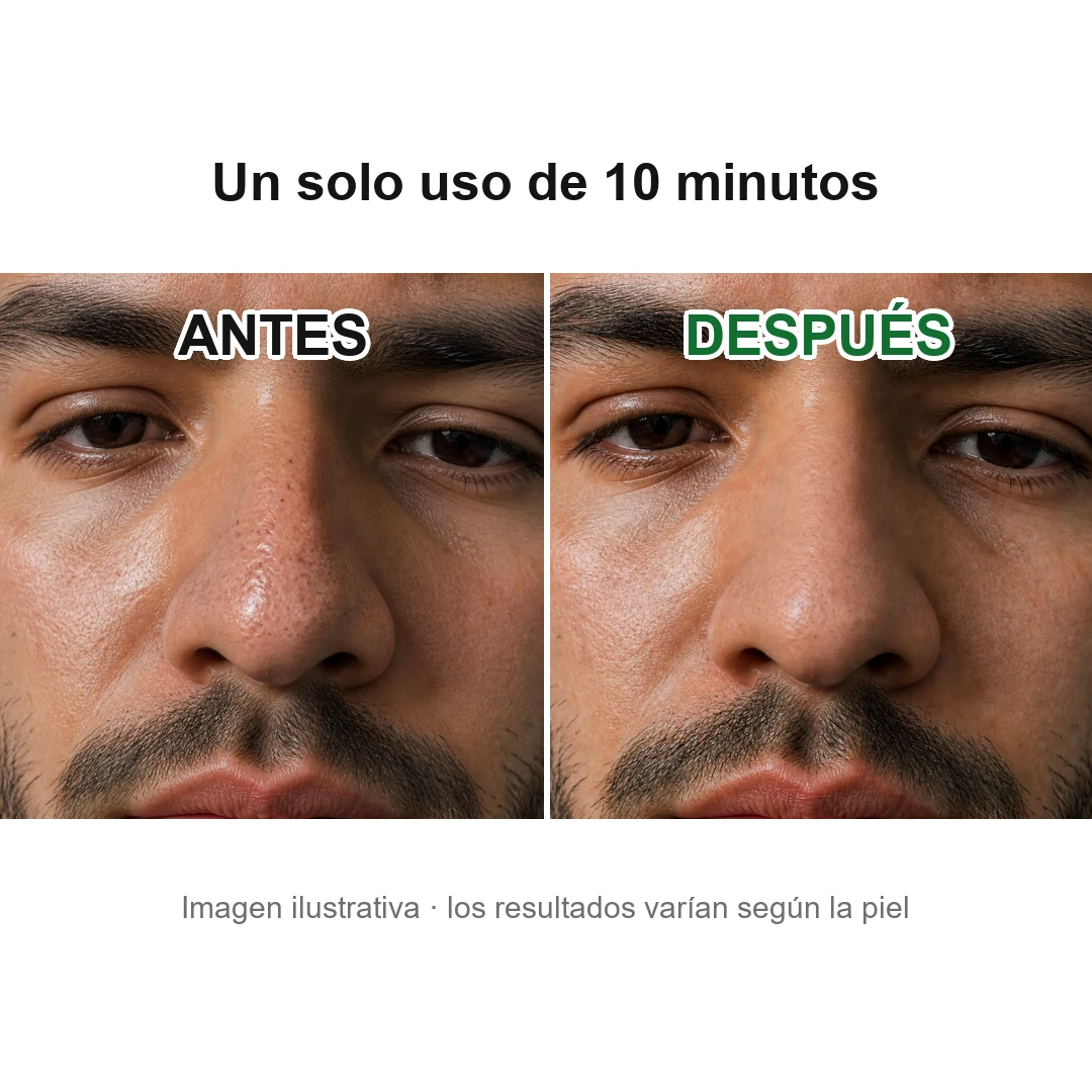 Antes y después de usar la mascarilla de té verde: nariz de un hombre
