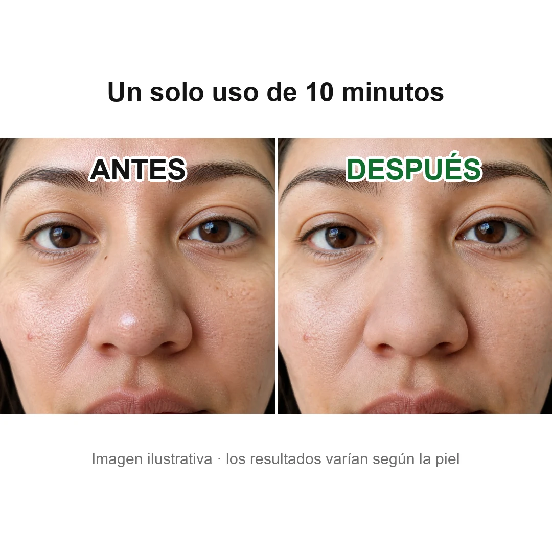 Antes y después de usar la mascarilla de té verde: nariz de una mujer